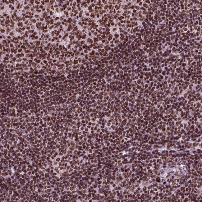 MTG16 Antibody in Immunohistochemistry (IHC)