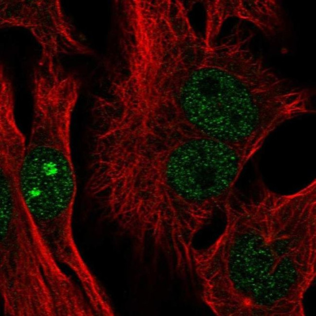 CTC-534A2.2 Antibody in Immunocytochemistry (ICC/IF)