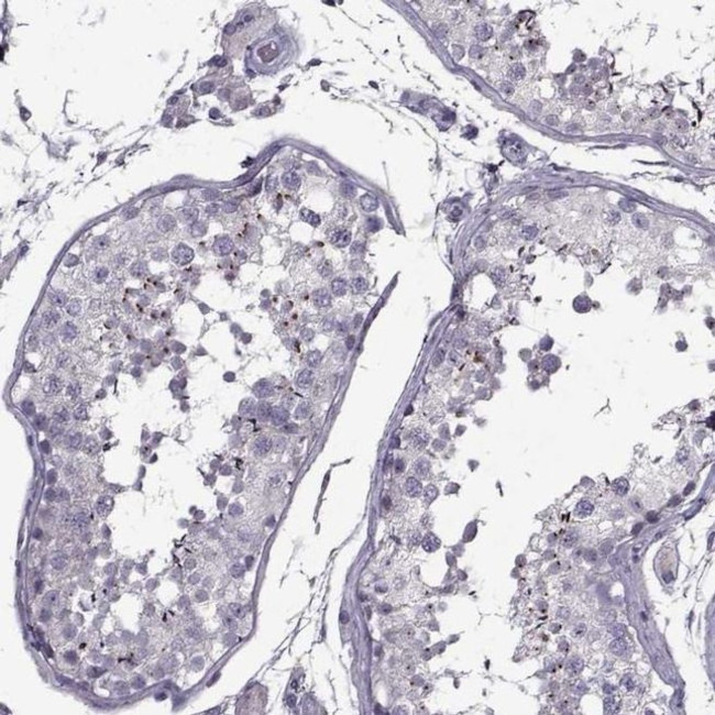 PP2D1 Antibody in Immunohistochemistry (IHC)