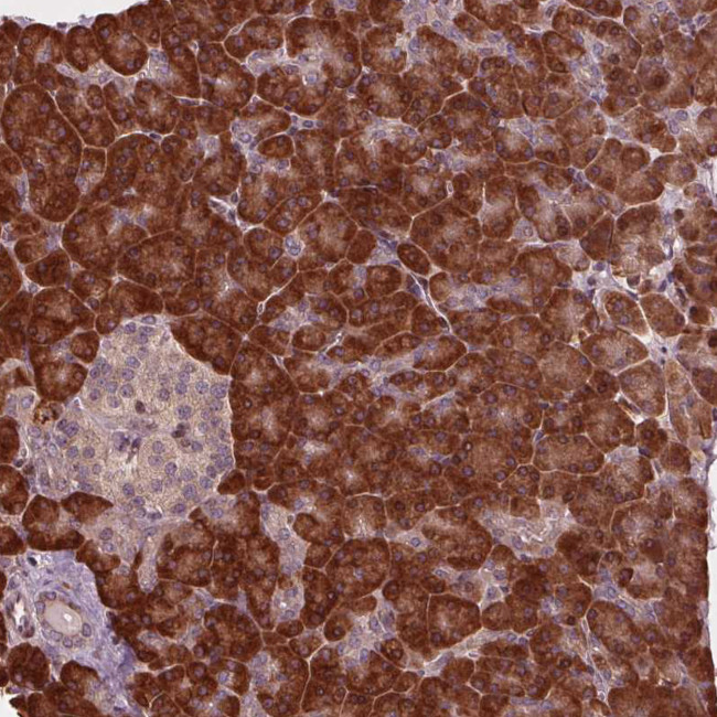 CMIP Antibody in Immunohistochemistry (Paraffin) (IHC (P))