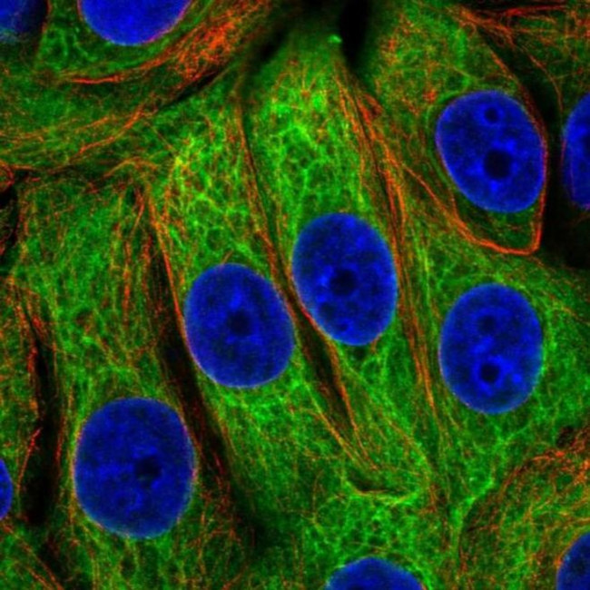 EPPK1 Antibody in Immunocytochemistry (ICC/IF)
