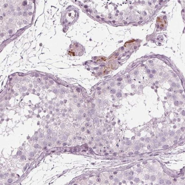 KRT28 Antibody in Immunohistochemistry (IHC)