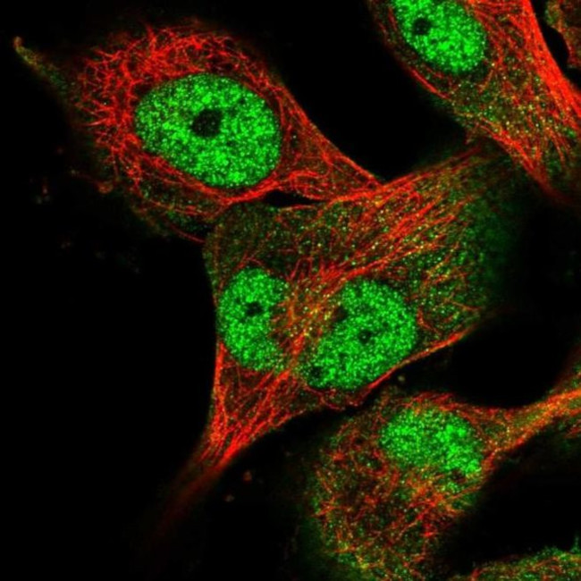 USP24 Antibody in Immunocytochemistry (ICC/IF)