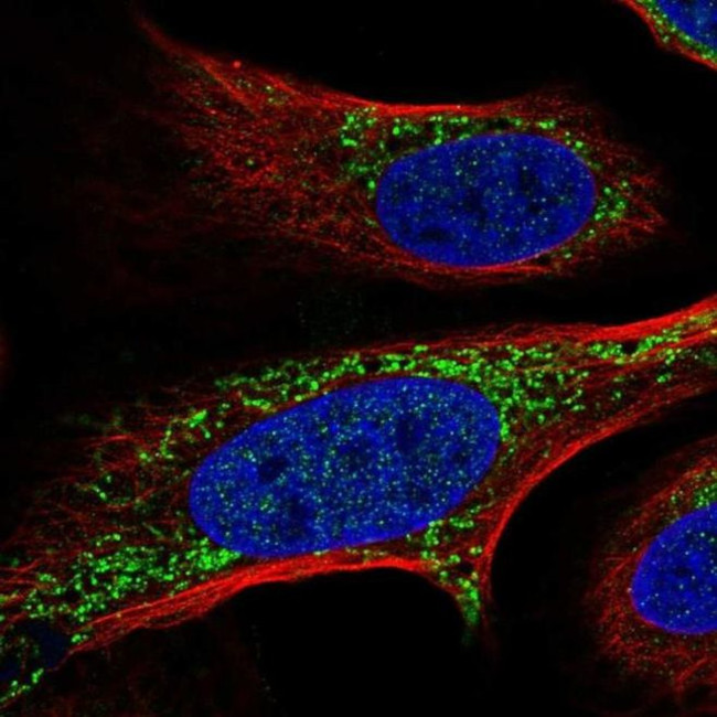 FASTKD2 Antibody in Immunocytochemistry (ICC/IF)