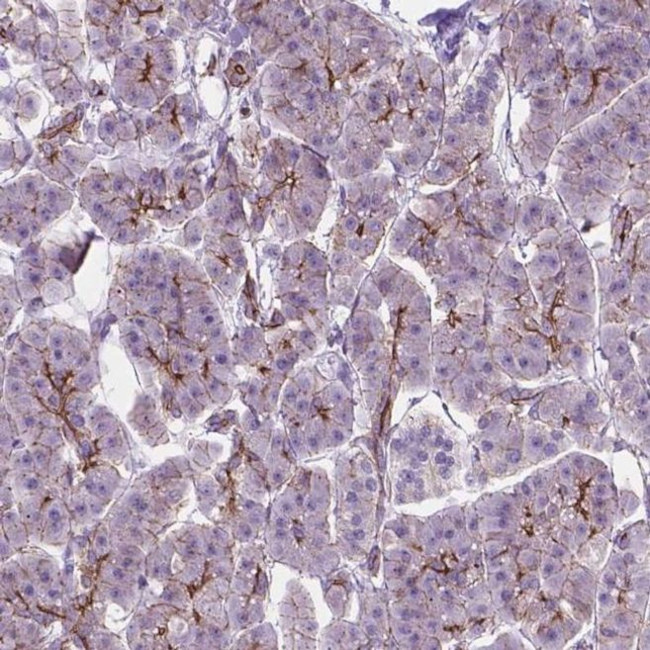 ARMS2 Antibody in Immunohistochemistry (IHC)