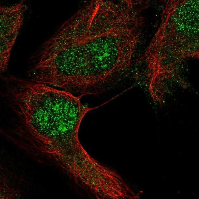 RGS12 Antibody in Immunocytochemistry (ICC/IF)