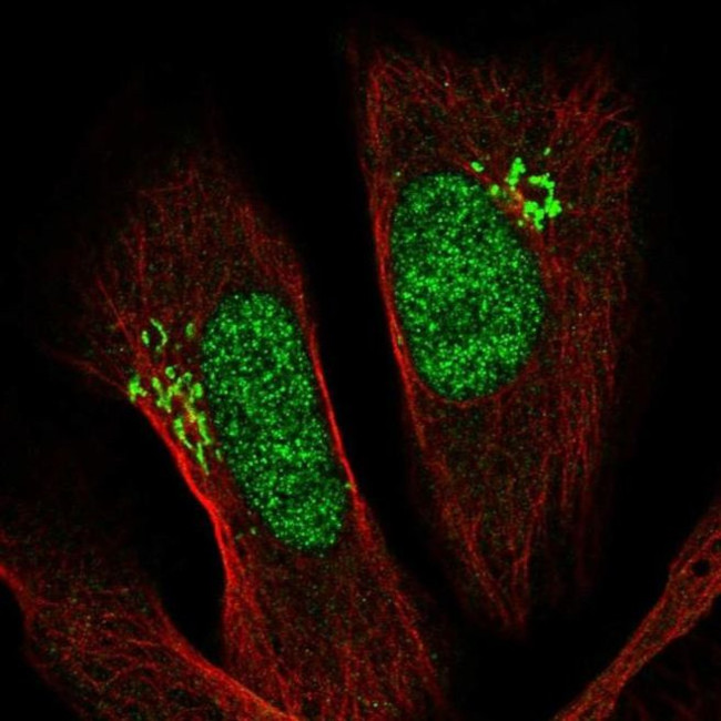 PSMD11 Antibody in Immunocytochemistry (ICC/IF)
