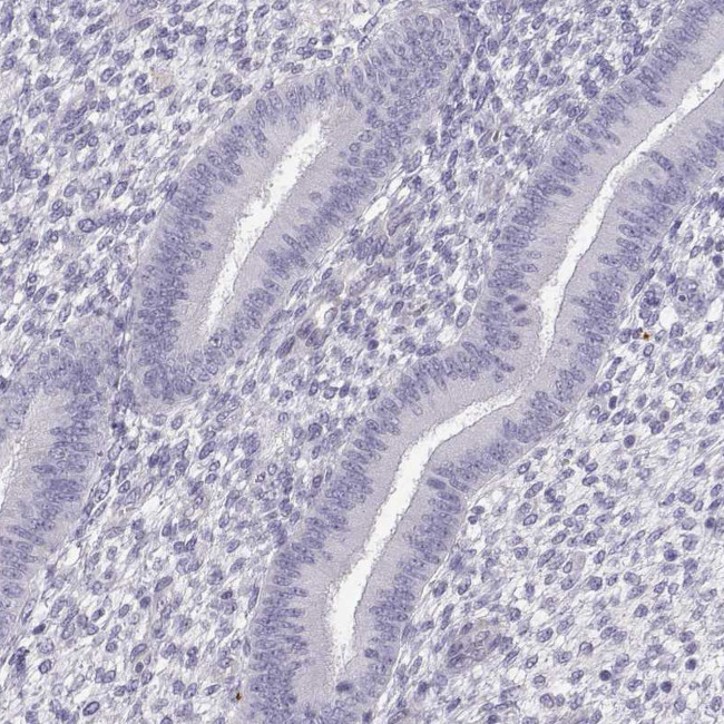 PP11 Antibody in Immunohistochemistry (Paraffin) (IHC (P))