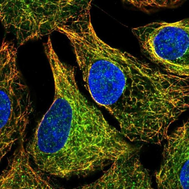 MTUS1 Antibody in Immunocytochemistry (ICC/IF)