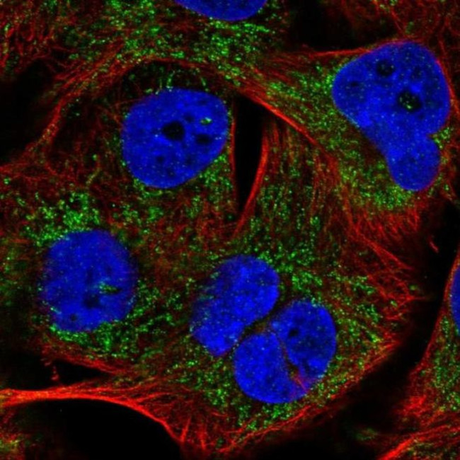 PHYHIP Antibody in Immunocytochemistry (ICC/IF)