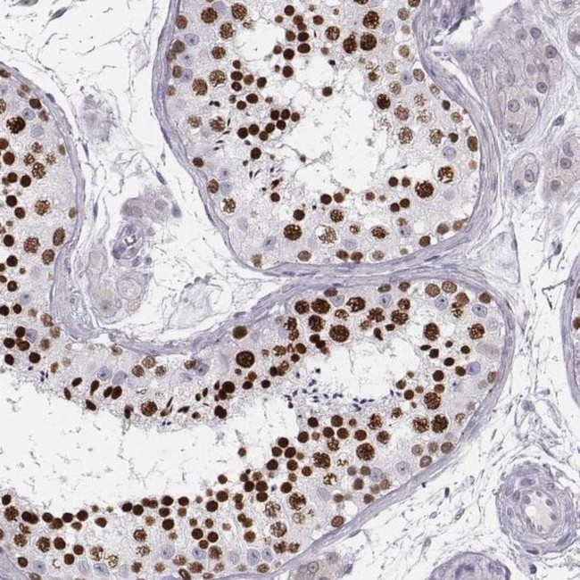 Histone H1T Antibody in Immunohistochemistry (IHC)