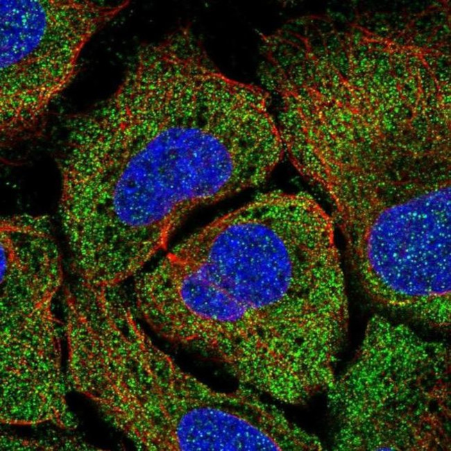 TPTE2 Antibody in Immunocytochemistry (ICC/IF)
