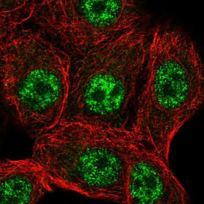 STK19 Antibody in Immunocytochemistry (ICC/IF)