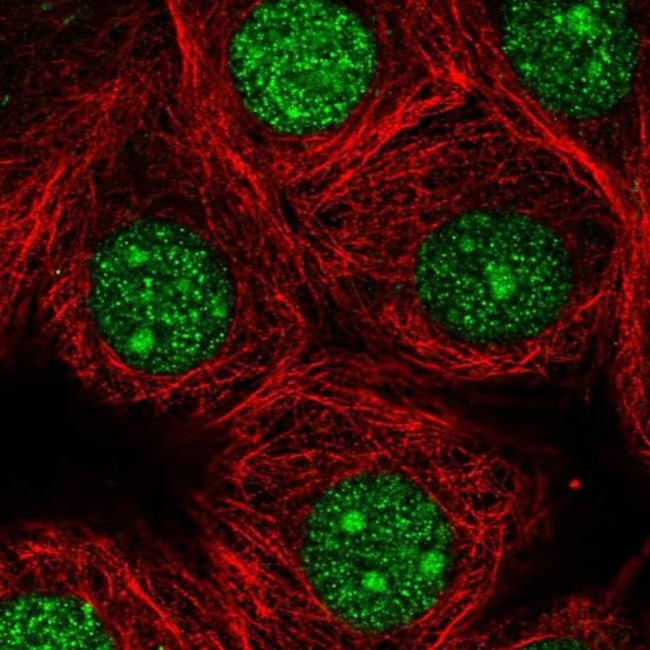 GMPR2 Antibody in Immunocytochemistry (ICC/IF)