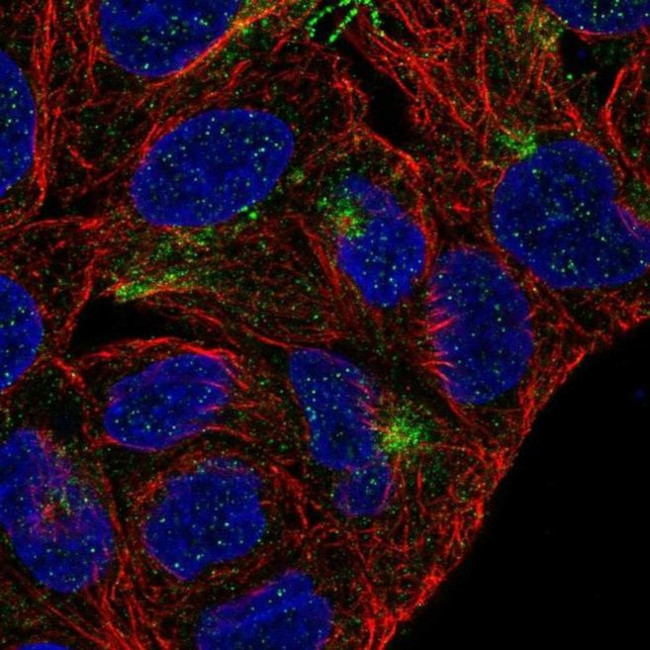TMEM63A Antibody in Immunocytochemistry (ICC/IF)
