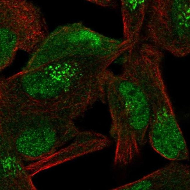 CAND1 Antibody in Immunocytochemistry (ICC/IF)