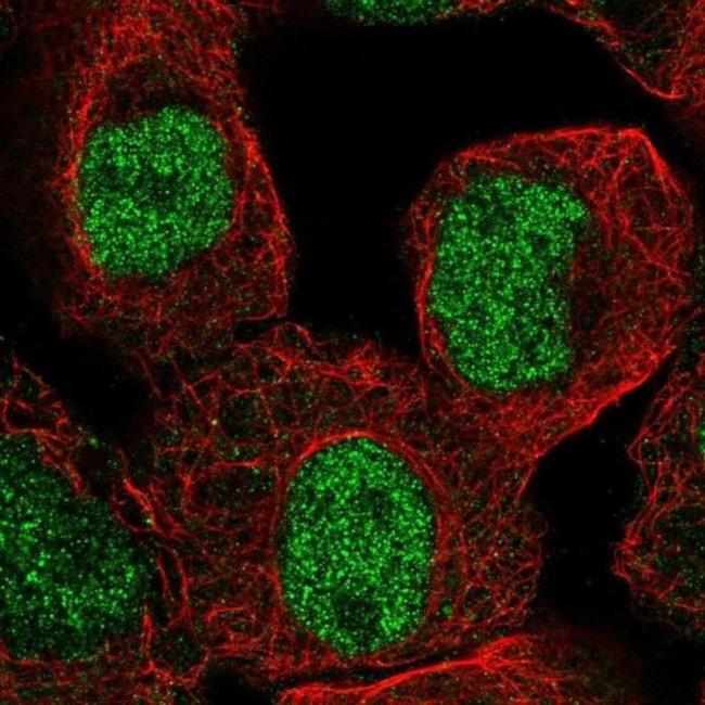 JMJD2C Antibody in Immunocytochemistry (ICC/IF)