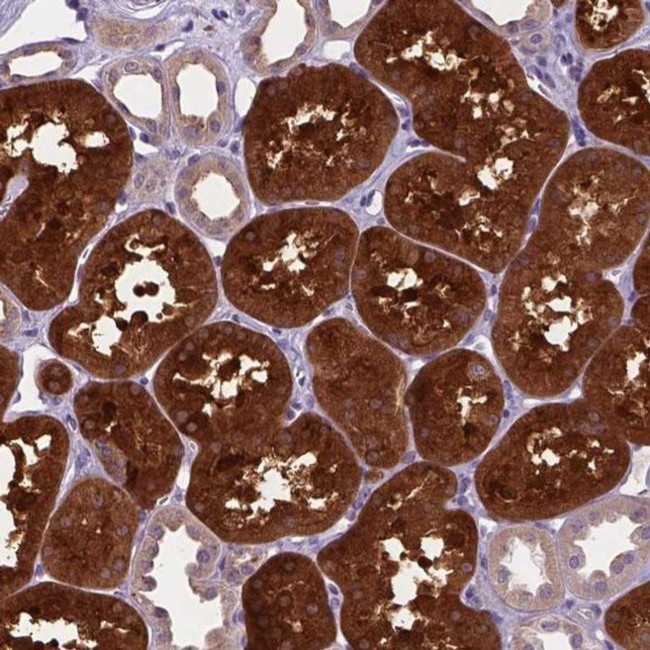 TM4SF18 Antibody in Immunohistochemistry (IHC)