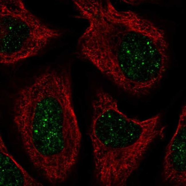 CNOT7 Antibody in Immunocytochemistry (ICC/IF)