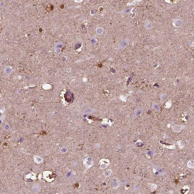 GDF11 Antibody in Immunohistochemistry (IHC)