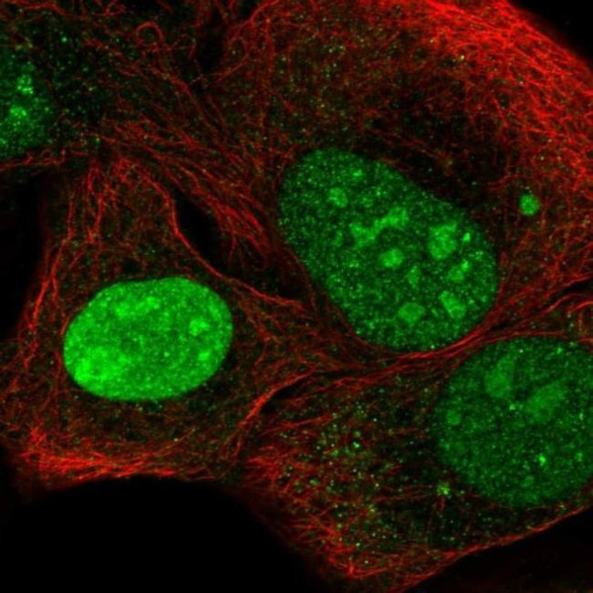 C3orf17 Antibody in Immunocytochemistry (ICC/IF)