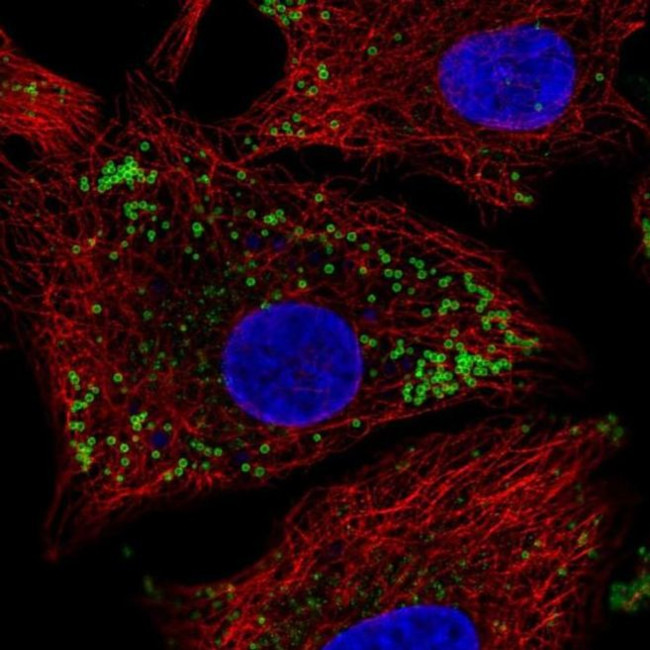 Krt222 Antibody in Immunocytochemistry (ICC/IF)