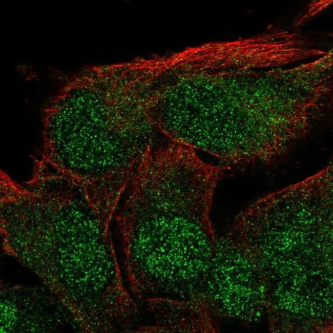 ZFYVE27 Antibody in Immunocytochemistry (ICC/IF)