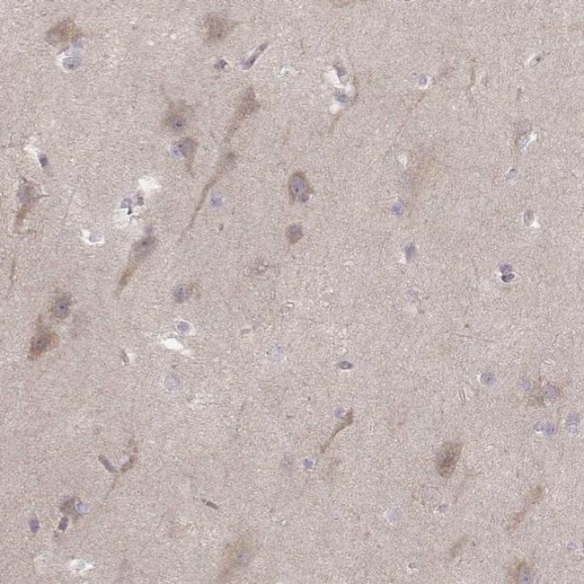 Kir3.3 (KCNJ9) Antibody in Immunohistochemistry (IHC)