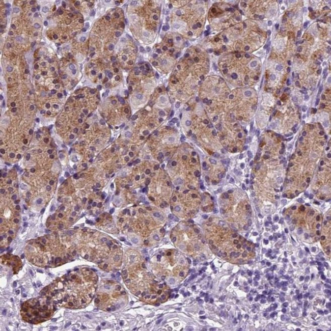 Hemicentin 2 Antibody in Immunohistochemistry (IHC)