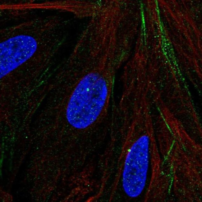 Mtmr9 Antibody in Immunocytochemistry (ICC/IF)