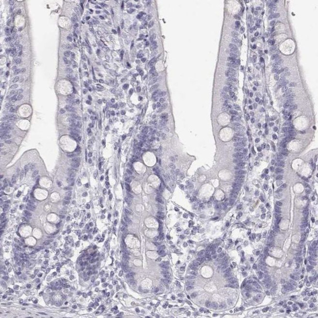KRTAP16-1 Antibody in Immunohistochemistry (IHC)