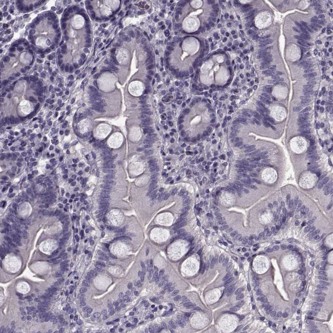 CCDC136 Antibody in Immunohistochemistry (Paraffin) (IHC (P))