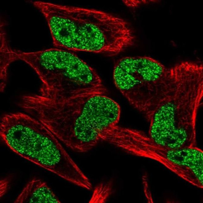 CCM2L Antibody in Immunocytochemistry (ICC/IF)