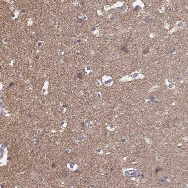 FRRS1L Antibody in Immunohistochemistry (IHC)