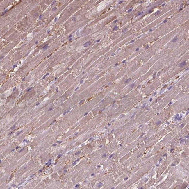 CRYBA4 Antibody in Immunohistochemistry (IHC)