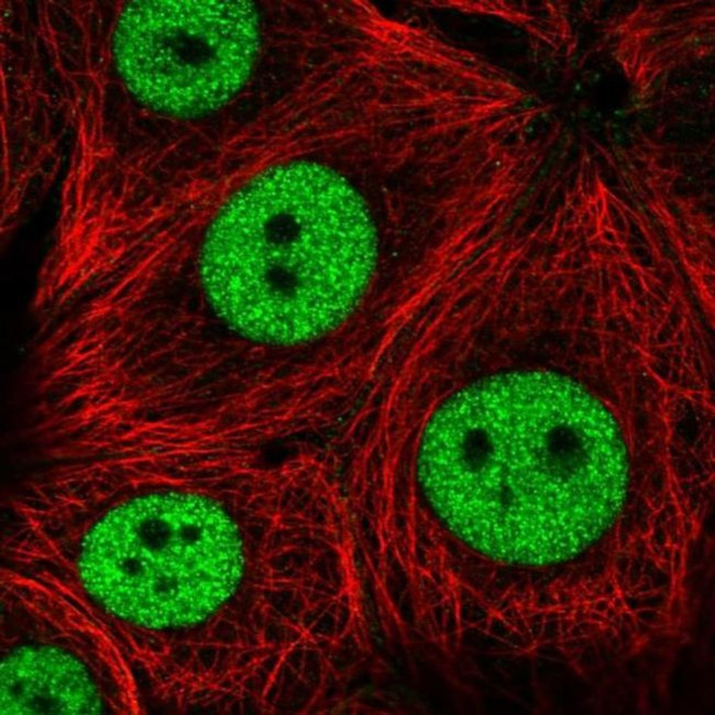 ZNF335 Antibody in Immunocytochemistry (ICC/IF)