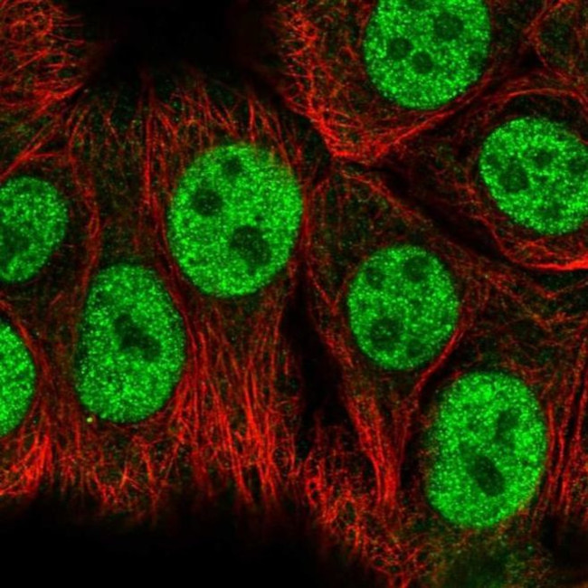 RBAK Antibody in Immunocytochemistry (ICC/IF)