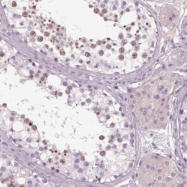 CD179b Antibody in Immunohistochemistry (IHC)
