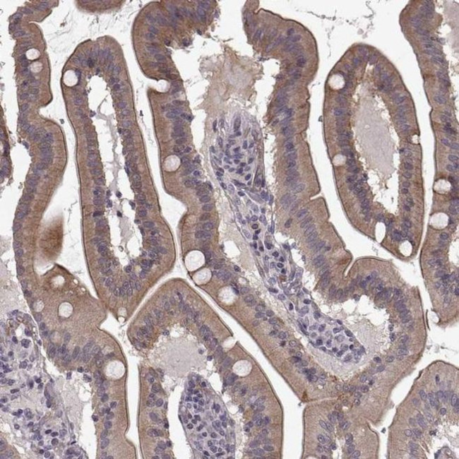 SLC22A18 Antibody in Immunohistochemistry (IHC)