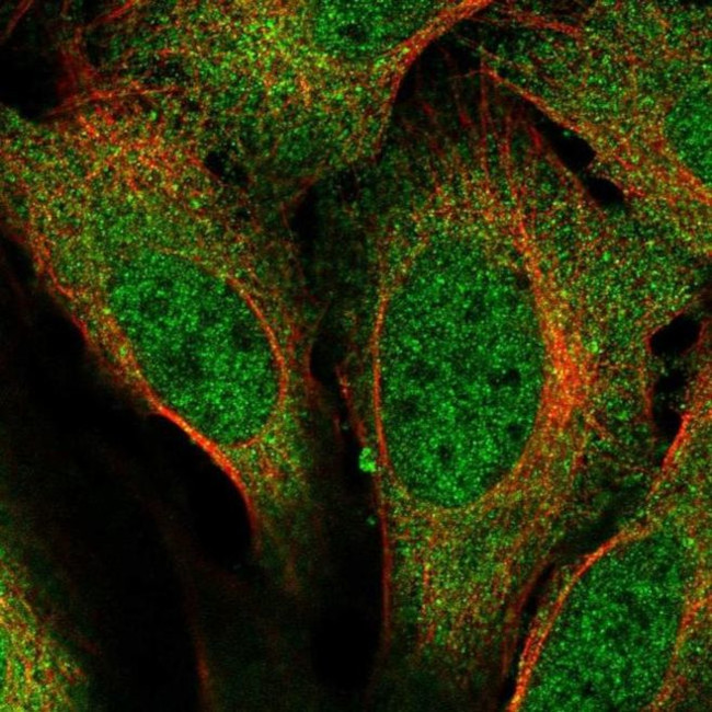 RMP Antibody in Immunocytochemistry (ICC/IF)
