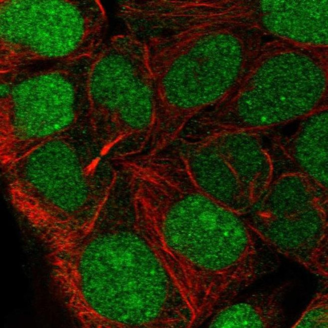 CCDC84 Antibody in Immunocytochemistry (ICC/IF)