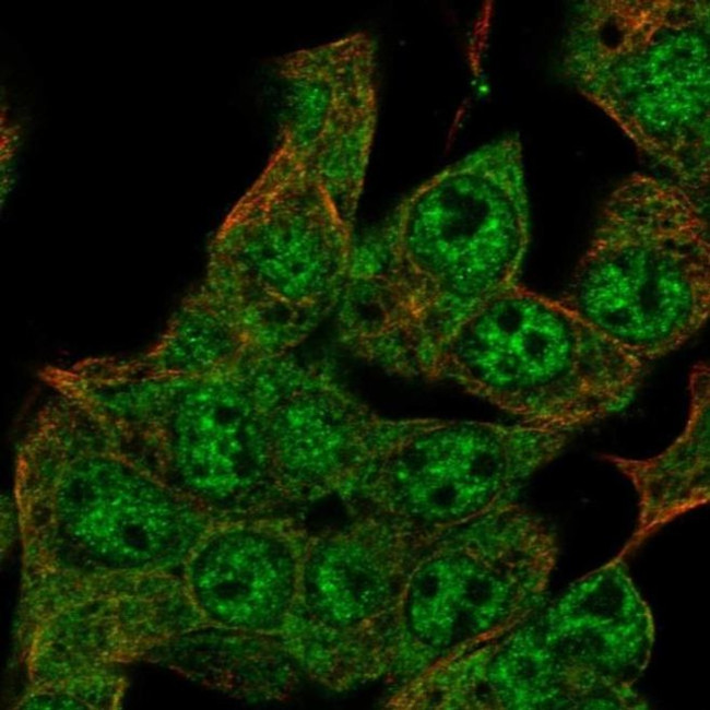 ZIM2 Antibody in Immunocytochemistry (ICC/IF)