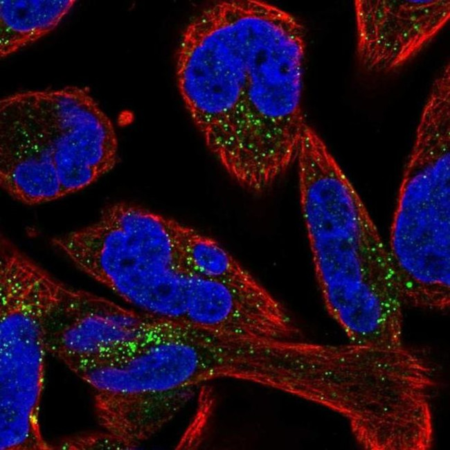 SMIM17 Antibody in Immunocytochemistry (ICC/IF)