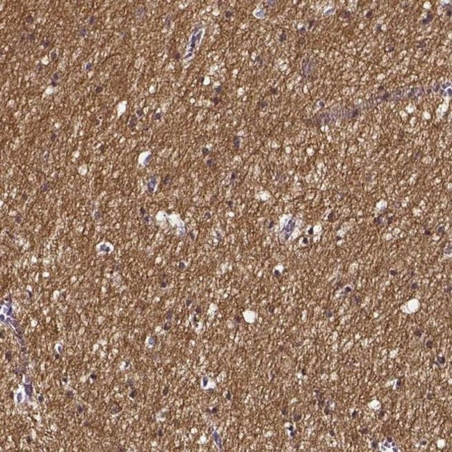 SMIM17 Antibody in Immunohistochemistry (IHC)