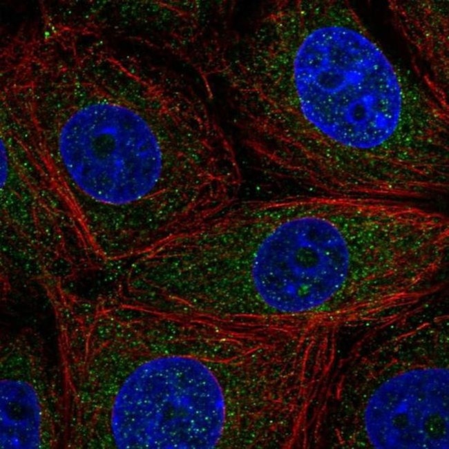 CCDC9 Antibody in Immunocytochemistry (ICC/IF)
