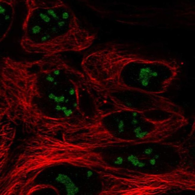 CC2D2B Antibody in Immunocytochemistry (ICC/IF)