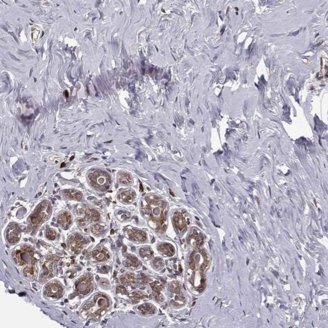 RPL31 Antibody in Immunohistochemistry (IHC)