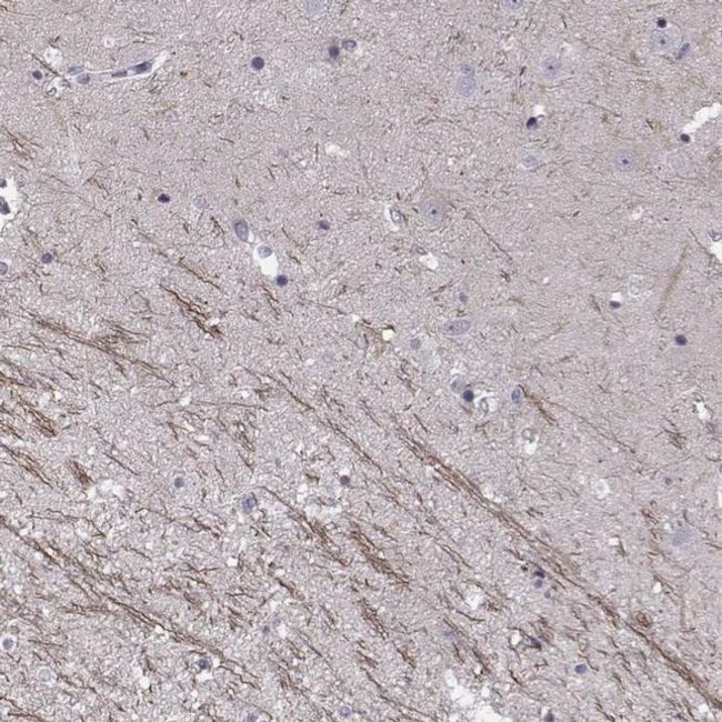 SNTG1 Antibody in Immunohistochemistry (IHC)