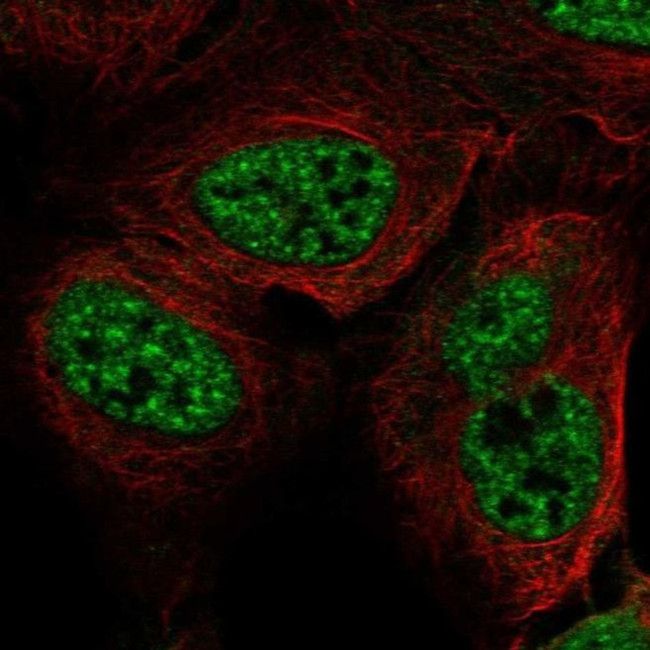 RFPL3 Antibody in Immunocytochemistry (ICC/IF)