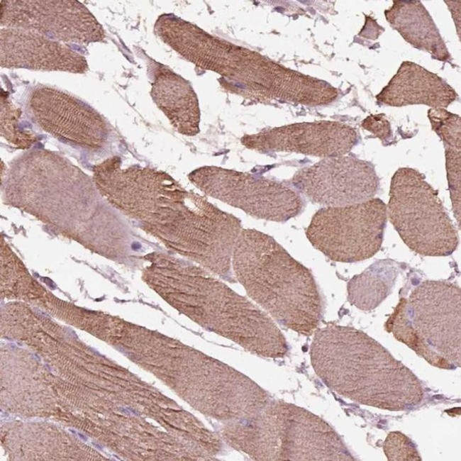 ITGB1BP3 Antibody in Immunohistochemistry (IHC)